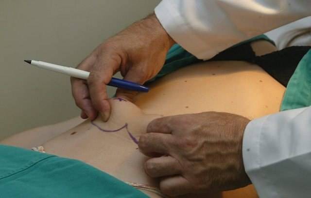 Médico especialista em cirurgias plásticas já está atendendo em Vilhena