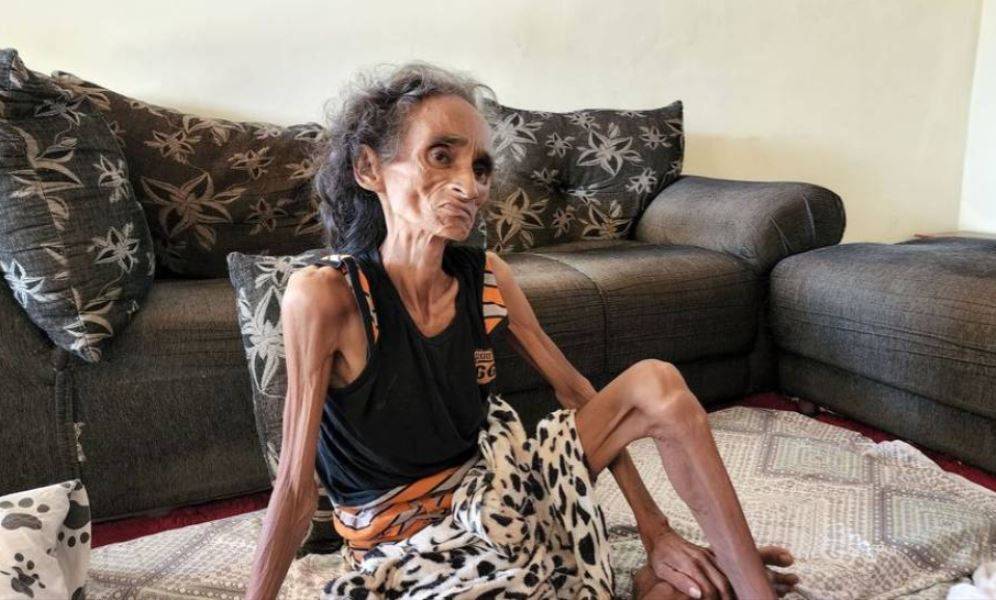 Chega ao fim o drama da ex-moradora de Chupinguaia que teve tratamento de câncer atrasado por falta de documentos