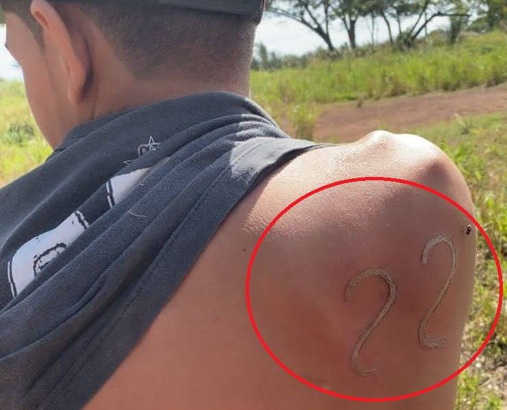 Com ferro em brasa usado para marcar gado, mato-grossense de 17 anos “tatua” nas costas o “número de Bolsonaro”