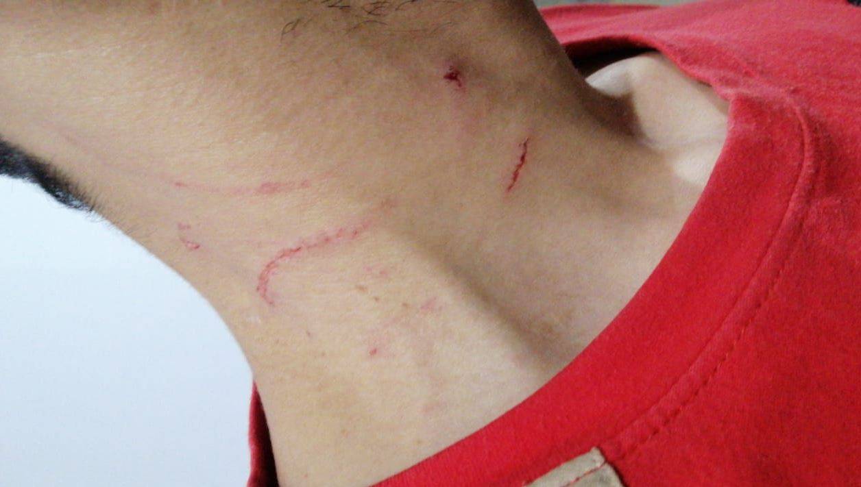 Polícia é acionada e prende mulher que, por não aceitar fim do casamento, havia espancado o ex-marido