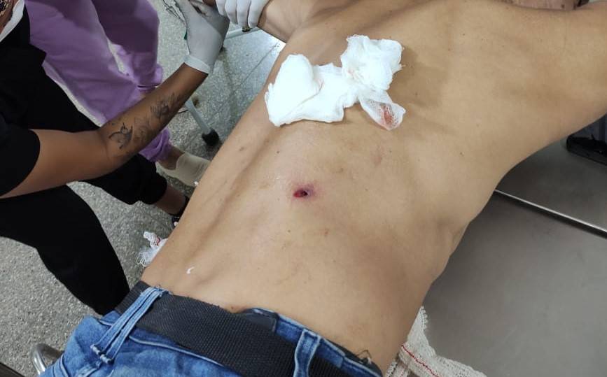 Discussão por causa da construção de muro termina com policial e vizinho baleados em Vilhena