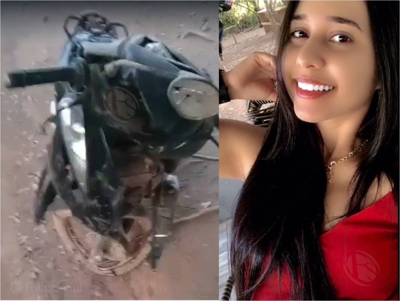 Garota de Cerejeiras passa por cirurgia em Vilhena após sobreviver a violento acidente; motorista fugiu sem prestar socorro