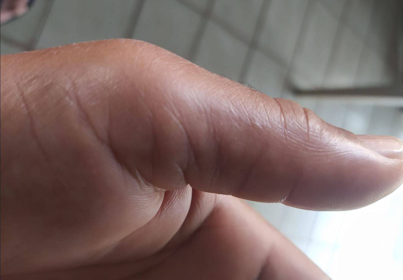 Fotógrafo denunciado por médica da UPA em Vilhena nega ofensas e revela que sogra morreu na unidade uma semana antes