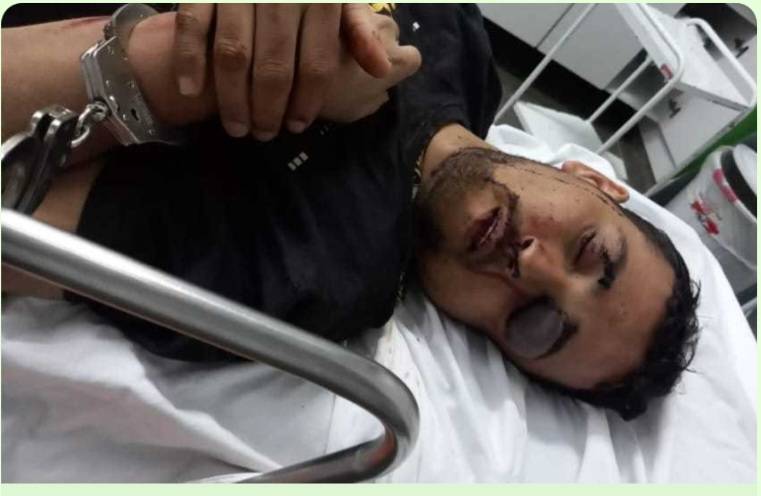 Vereador-empresário espancado e preso quando tentava furtar gado não resiste a ferimentos e morre em hospital de MT