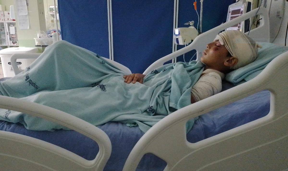 Garoto vilhenense de 11 anos atropelado por motociclista que não prestou socorro é transferido para Cacoal e está internado em UTI