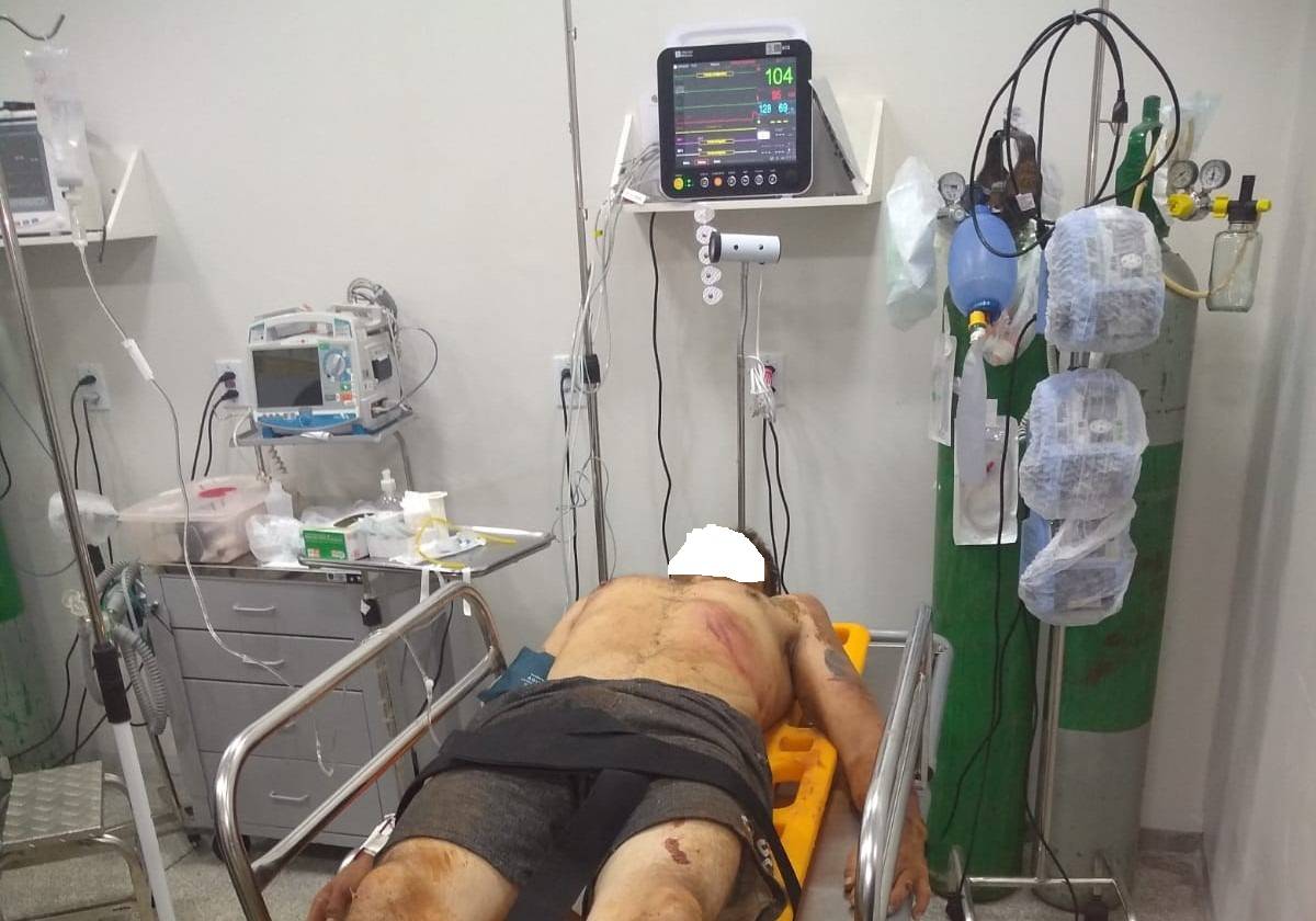 Aparentemente surtado, homem ataca carros com facão em rodovia e é espancado por populares, em Vilhena