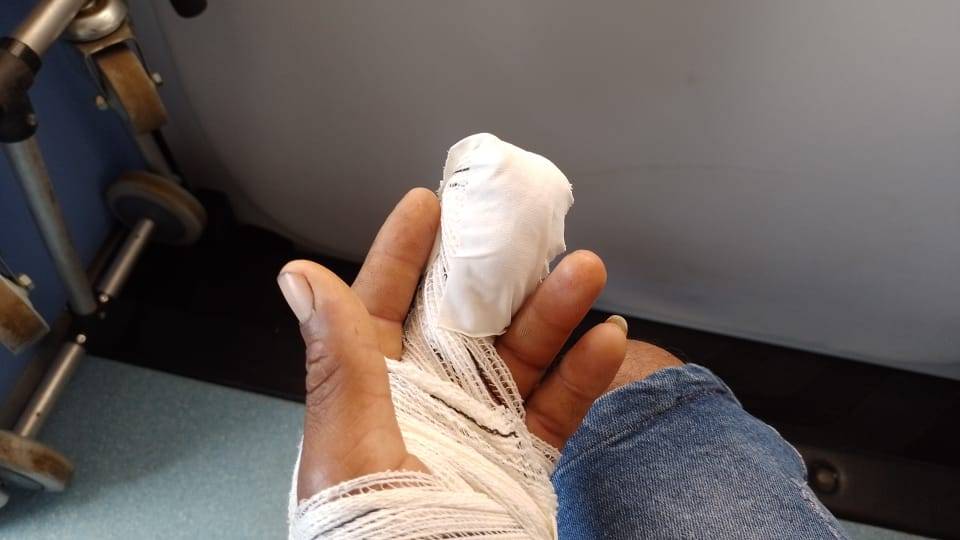 Socorrido em Cerejeiras por ambulância de Cabixi, acidentado é operado em Vilhena e deixado no meio do caminho na volta