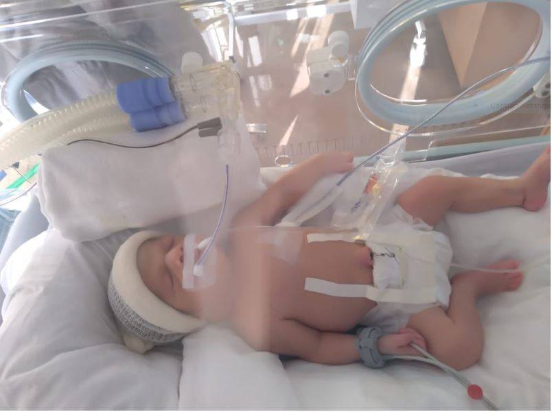 Manicure de Vilhena pede ajuda para salvar a filha bebê que nasceu de 32 semanas e precisou ser transferida para outra cidade
