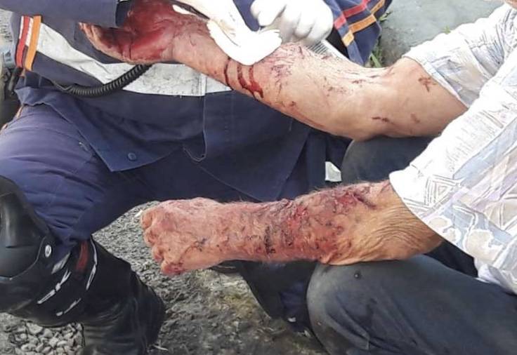 Atacado por cão da raça pit bull em cidade de MT, idoso reage e desfere canivetada no pescoço do animal