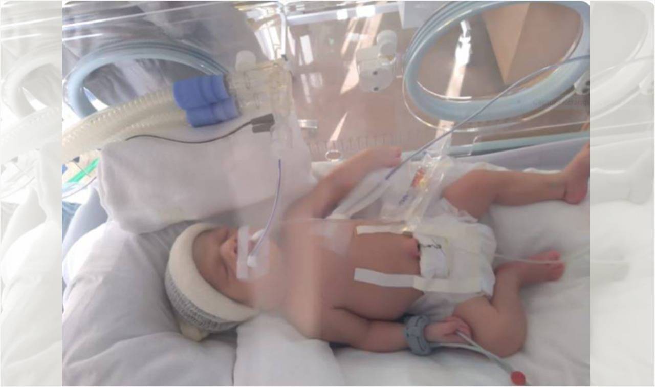 Com bebê de menos de um mês na UTI em Ouro Preto do Oeste, manicure vilhenense pede ajuda para custear acompanhamento da filha