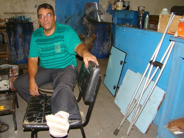 “Atropelado” por cachorro de rua, eletricista passa por cirurgia