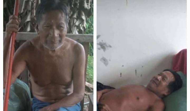 Indígena que viu nascimento de município do Cone Sul de Rondônia morre aos 64 anos no Hospital Regional de Vilhena