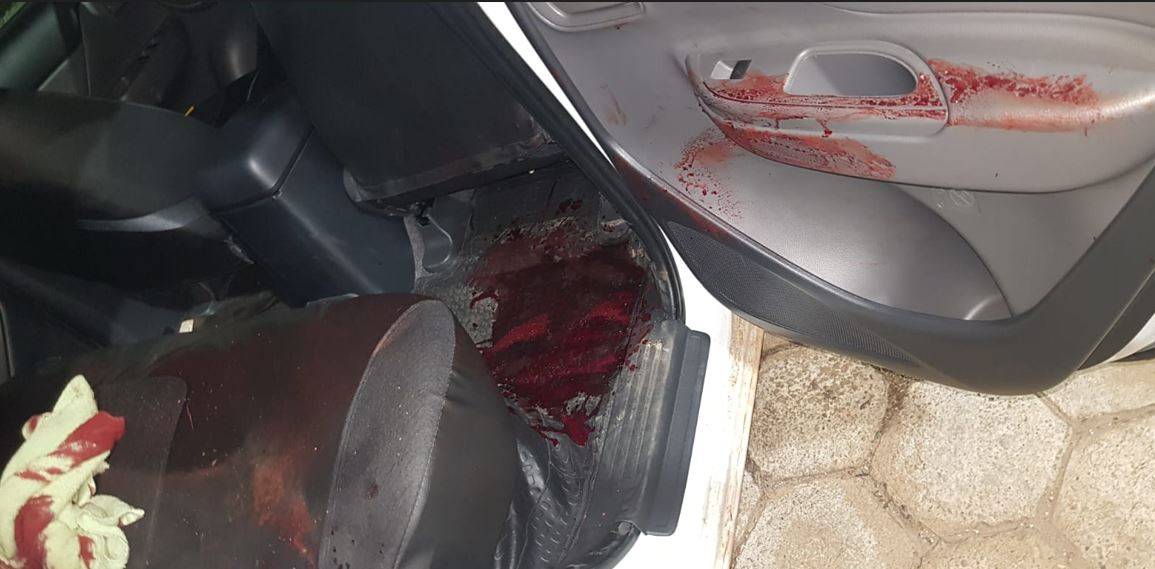 Pneu de carreta explode e desfigura rosto de caminhoneiro vilhenense, que teve a vida salva por policiais militares de MT