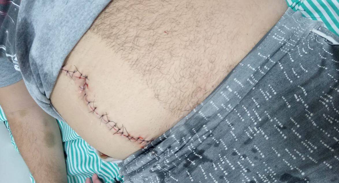 Aposentada critica “diagnósticos” feitos por médicos e diz que apendicite poderia ter matado seu filho