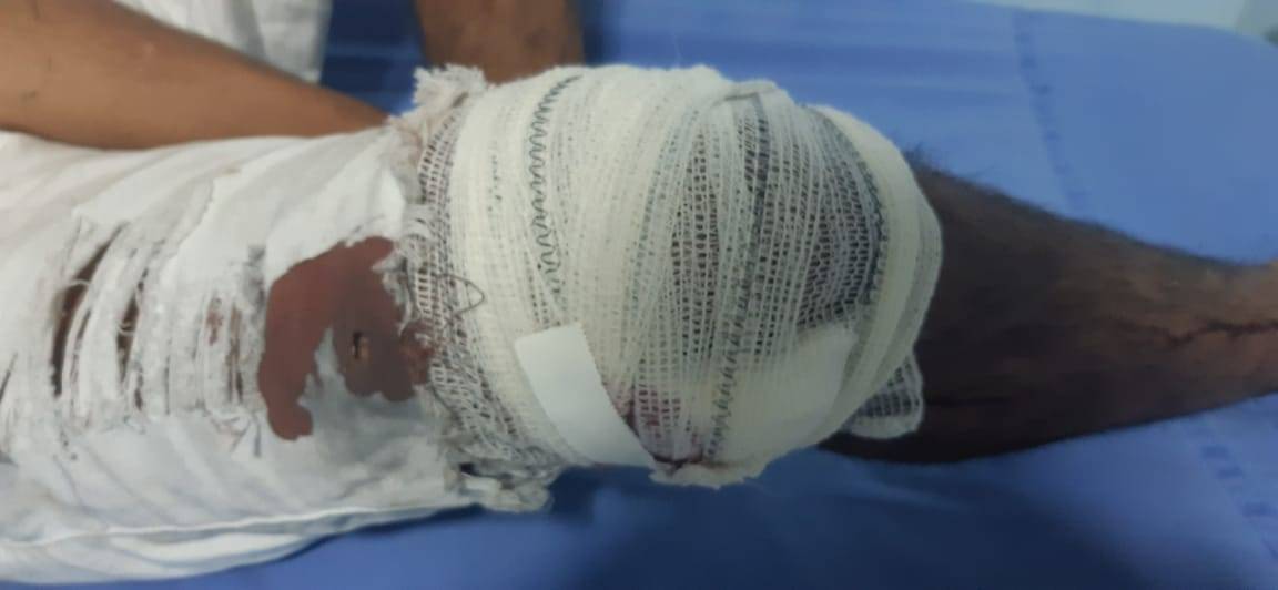 Homem dispara tiro acidental em Colorado do Oeste e acaba preso junto com mulher e filho que xingaram e atacaram policiais