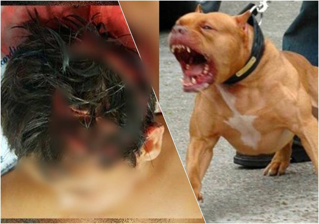 Garotinha de apenas 02 anos é violentamente atacada por cadela pit bull da família e passa por cirurgia, em Vilhena