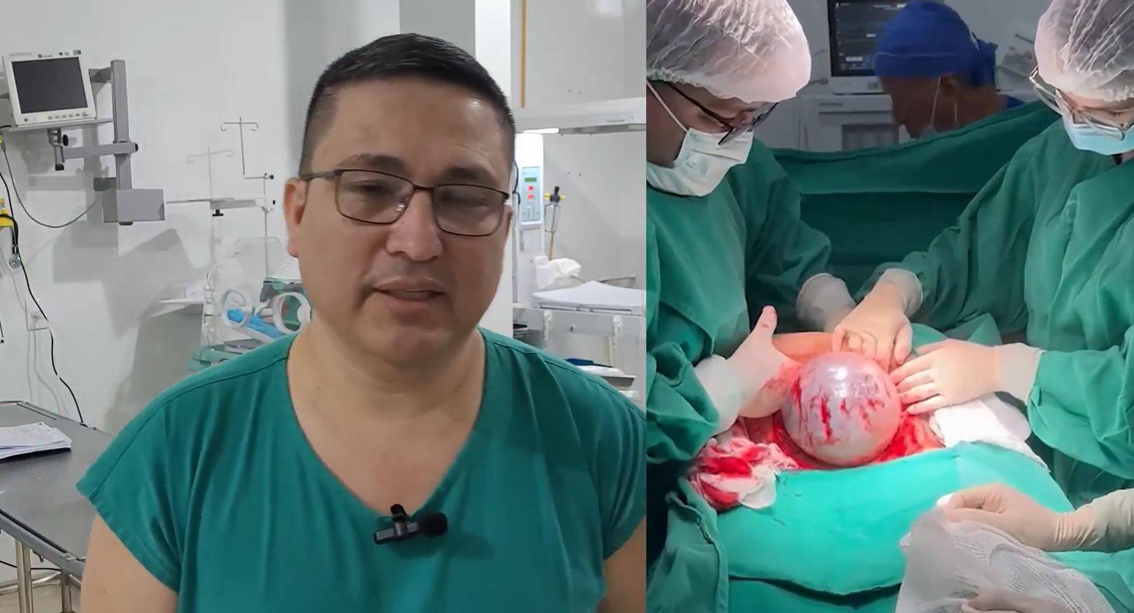 ASSISTA VÍDEO: bebê nasce em Vilhena através de parto que só é feito a cada 85 mil nascimentos