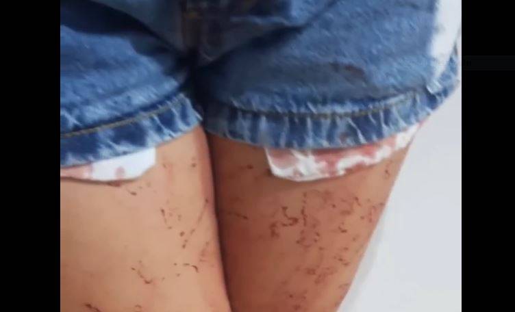 ASSISTA VÍDEO: mulher sequestrada em cidade vizinha recebe atendimento médico após ter o rosto atingido durante a fuga