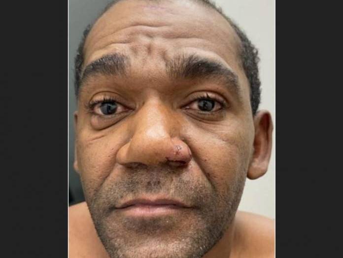 Reportagem do FOLHA DO SUL ON LINE leva à prisão do homem acusado de matar mulher com problemas mentais em Vilhena