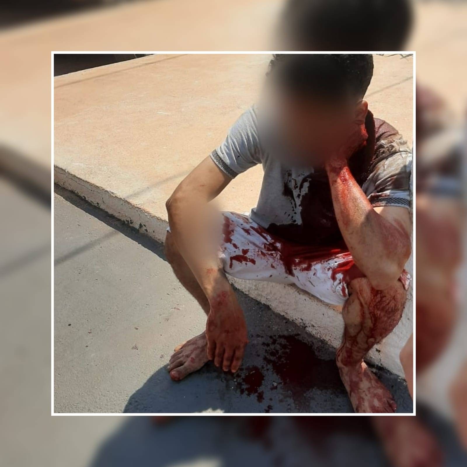 VÍDEO IMPRESSIONANTE:  comerciante reage a assalto e atinge ladrões a tiros em Cacoal; baleados estão no mesmo hospital
