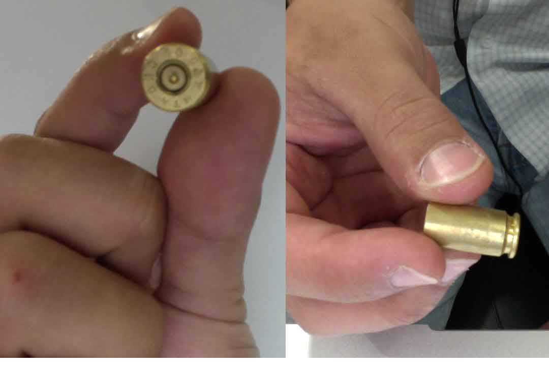 Homem sobrevive após ser atingido por três tiros de pistola e passa por cirurgia no Hospital Regional de Vilhena