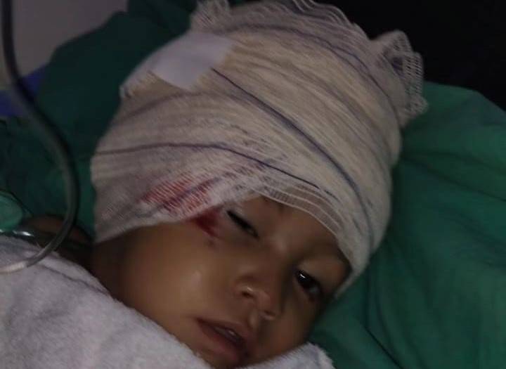 Menino de 1 ano e 5 meses atacado por cachorro na área rural de Corumbiara passa por cirurgia delicada em Vilhena