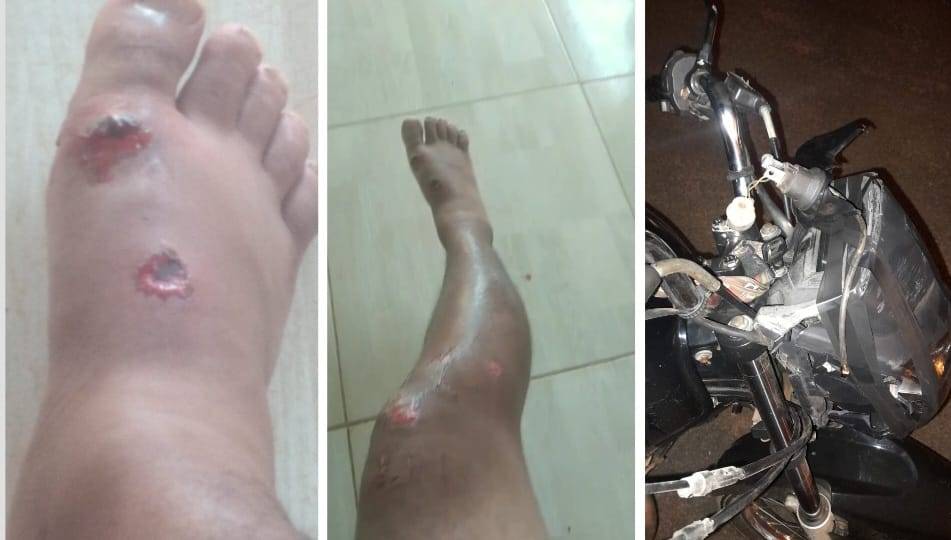 VÍDEO: motoboy que sofreu acidente em Vilhena faz rifa para compra de medicamentos e conserto de sua motocicleta