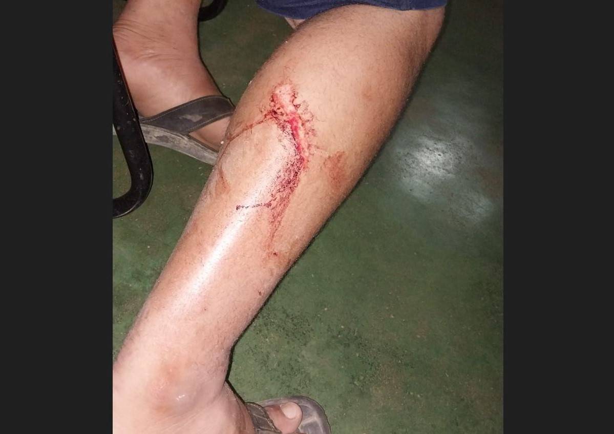 Guia turístico atacado com zagaia por vice-prefeito de Pimenteiras do Oeste registra queixa contra o político na Polícia Civil