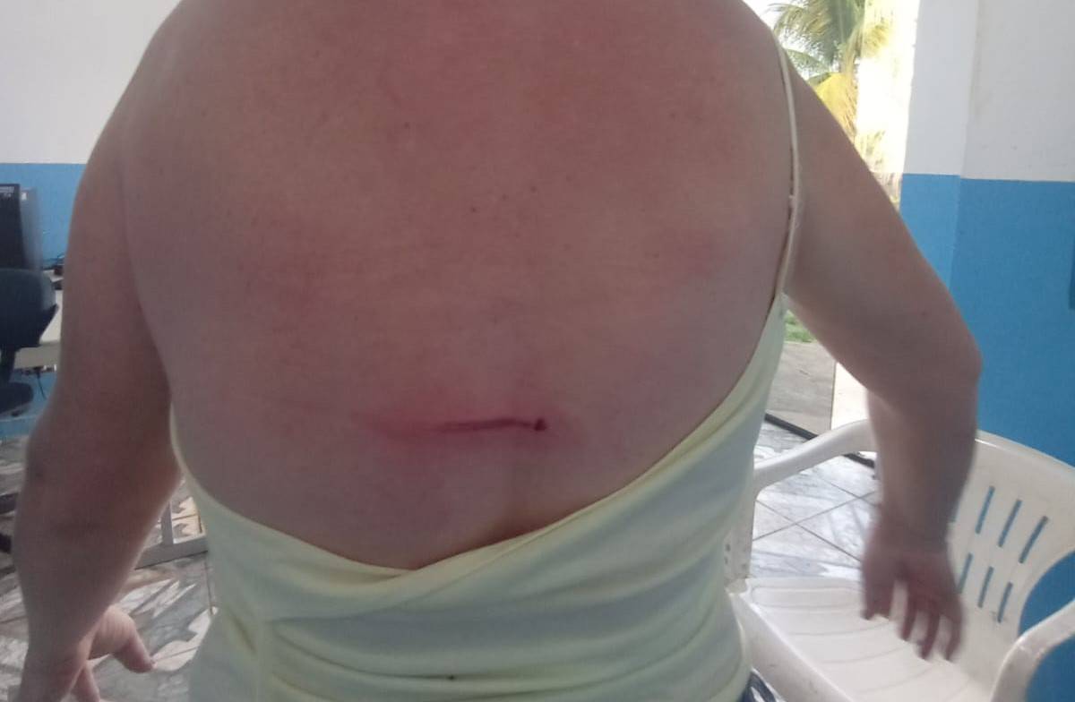 Esposa do vice-prefeito de Pimenteiras do Oeste também aciona a polícia e dá detalhes da briga dela e do marido com piloteiro