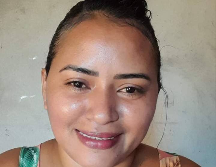 Morre a mulher que acusava o marido de ter jogado álcool e ateado fogo em seu corpo, em Cacoal; FOLHA DO SUL obteve detalhes do caso