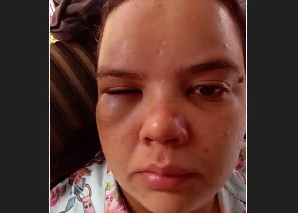 VÍDEO: mulher que teve marido assassinado em Vilhena denuncia violência doméstica; caso revive morte do filho de ex-prefeito