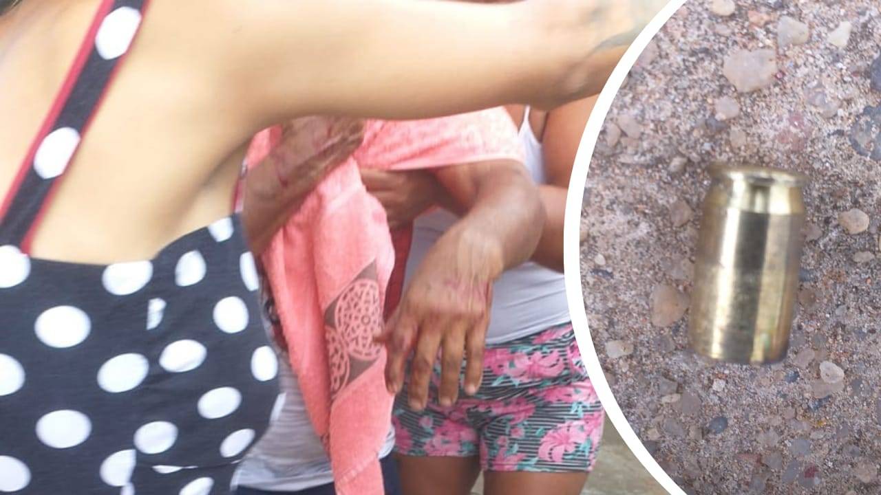 Aposentado baleado “no lugar” do neto em Vilhena tem 73 anos, já recebeu alta de hospital e foi levado para Casa de Detenção