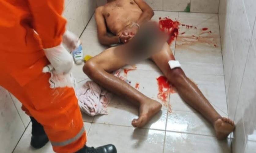 Homem assassinado a tiros dentro de casa em Cerejeiras já havia sido baleado pela polícia em assalto