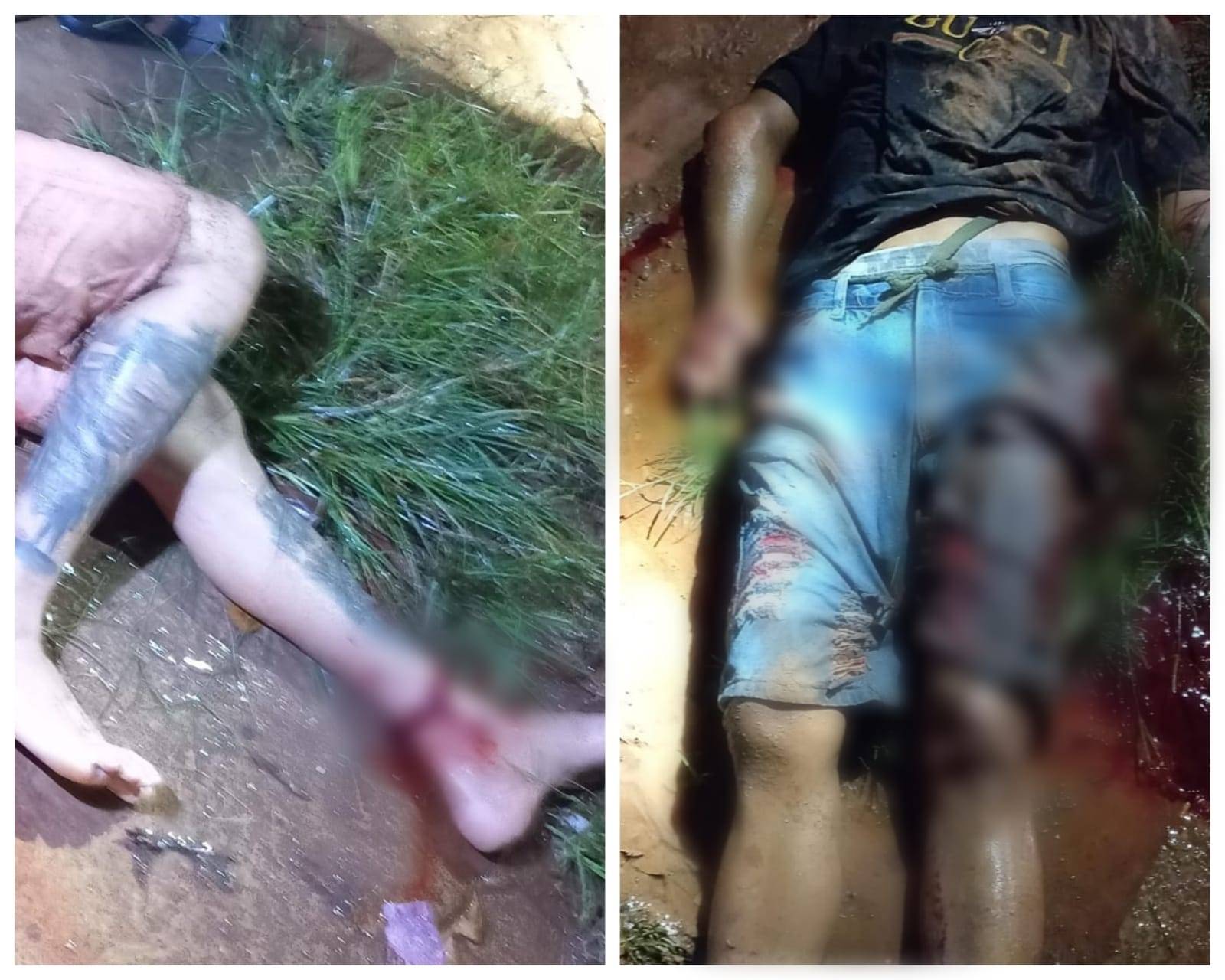 Irmão de Melgipson, Bruce Willi é baleado e precisa ter dedos amputados; ele está na UTI do Hospital Regional de Vilhena