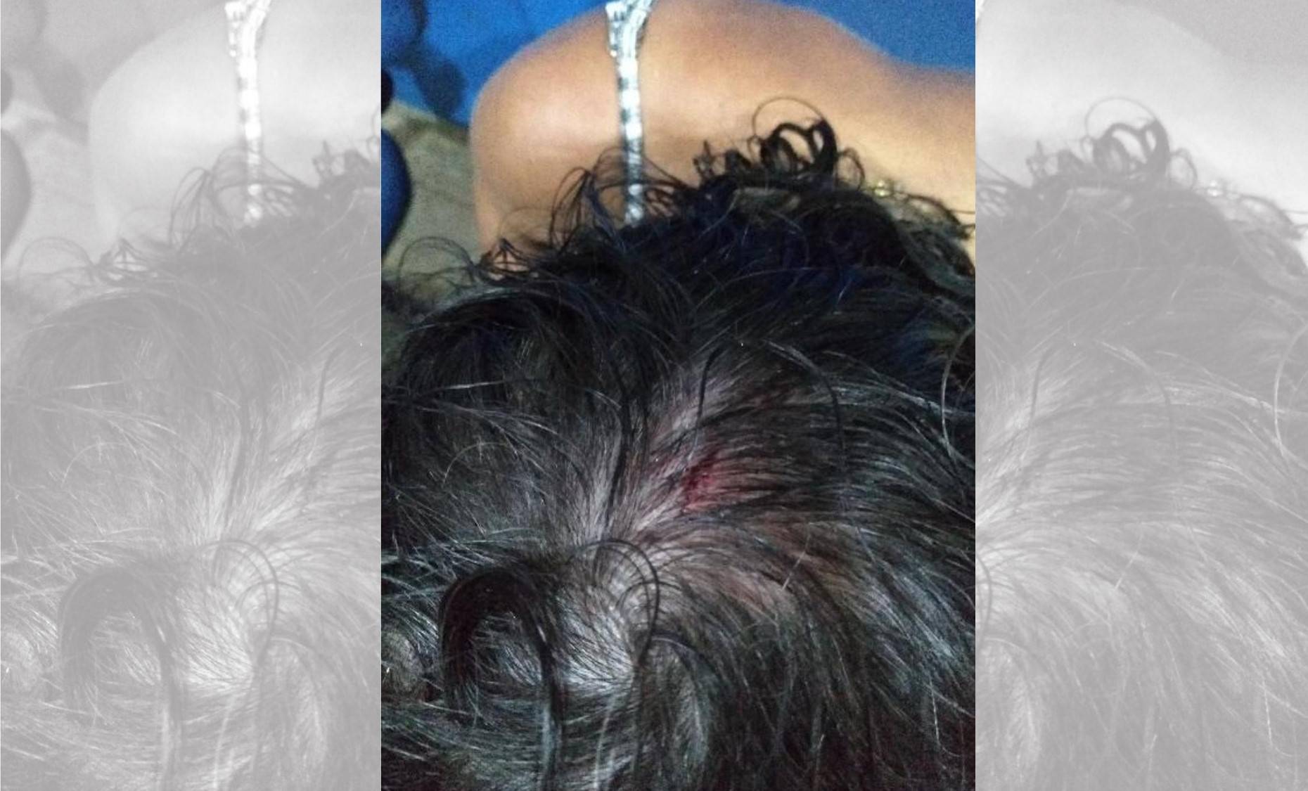 Casal fica ferido ao defender mulher que estaria sendo espancada pelo marido e vítima nega agressões à polícia