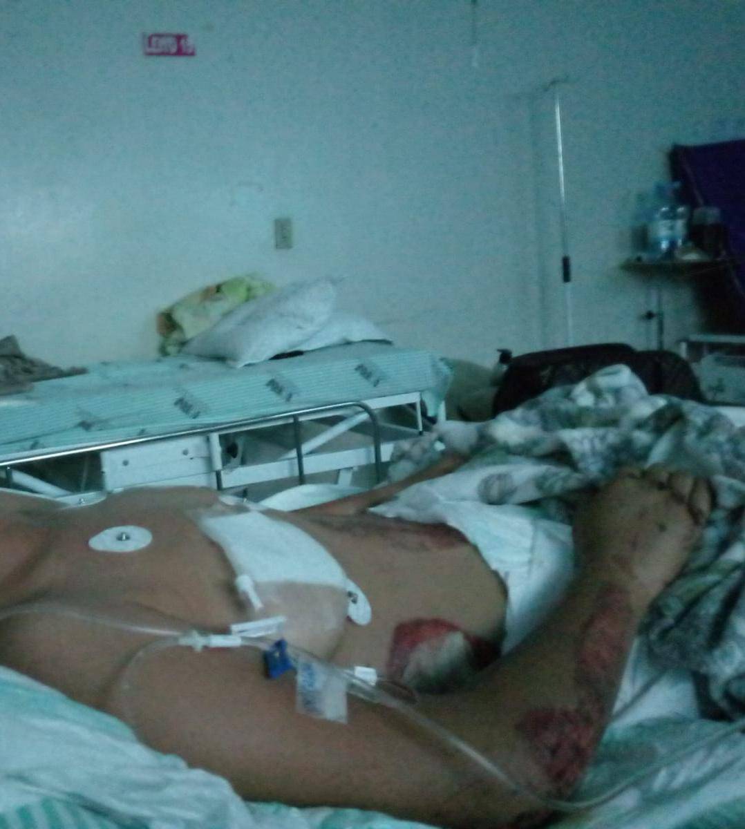 Após briga por postagem na internet, garota que estava sendo trazida para Vilhena cai de viatura na BR 364 e sofre ferimentos graves