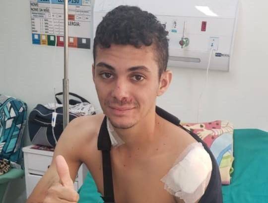 Vaqueiro de 22 anos que teve perna amputada ao desviar de buraco na BR 364 precisa de ajuda e pai lidera campanha