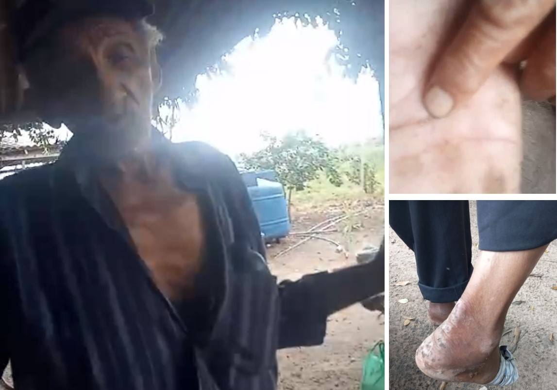 VEJA VÍDEO: vizinha cobra autoridades e tenta ajudar idoso que vive sozinho e em situação degradante na área rural de Vilhena