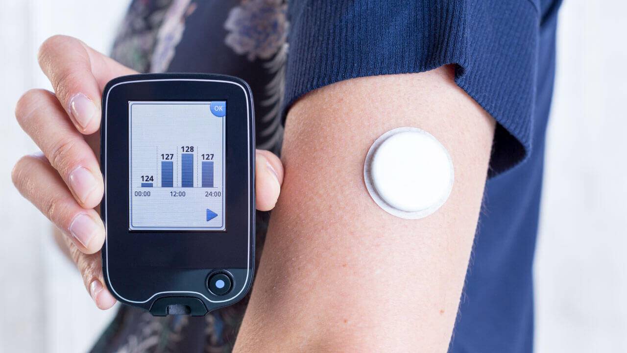 Pais de crianças e adolescentes com Diabetes Tipo 1 comemoram lei municipal que assegura sensor para monitoramento da glicose