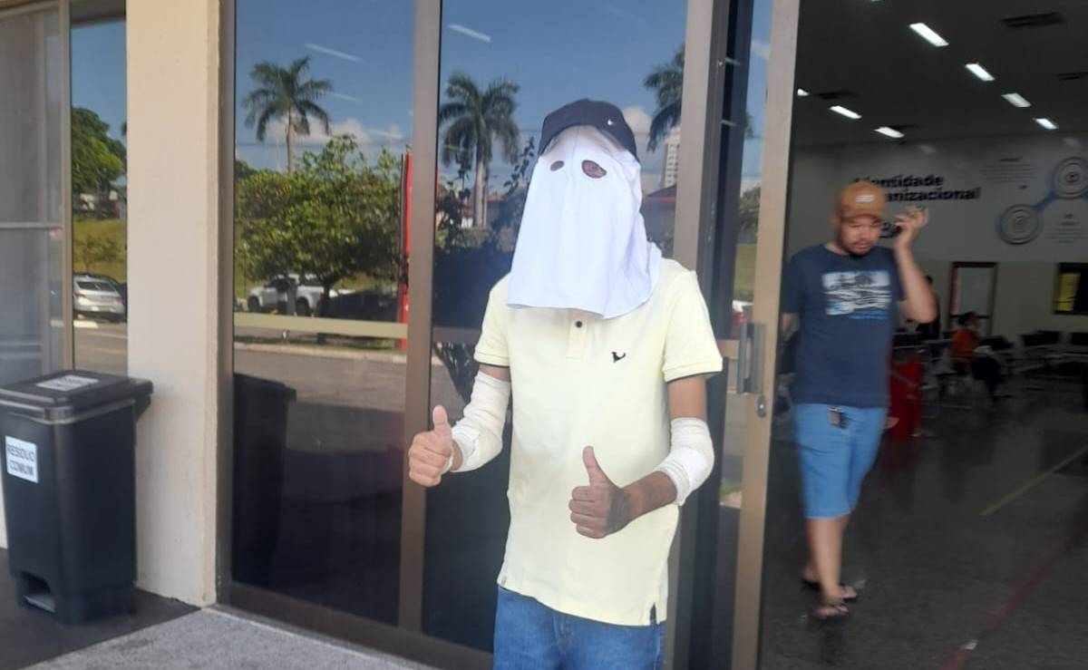 Vilhenense de 20 anos que perdeu um olho e foi transferido em UTI aérea para Goiânia após acidente deixa hospital; médicos falam em “milagre”