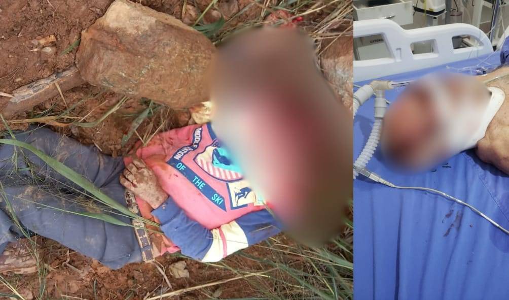 Espancado e encontrado sangrando em Colorado do Oeste, homem de 72 anos é intubado e transferido em estado grave para Cacoal