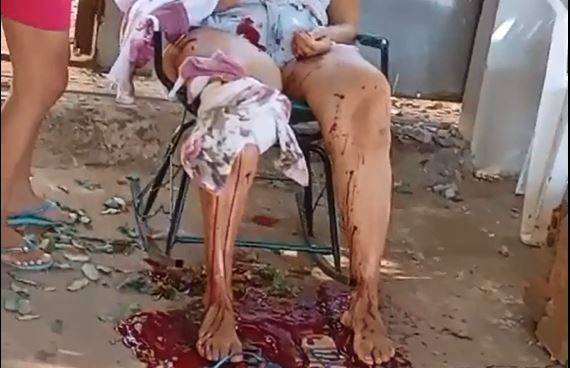 Horas após rapaz de 23 anos ser executado a tiros, mulher também é alvejada com vários disparos, em Vilhena