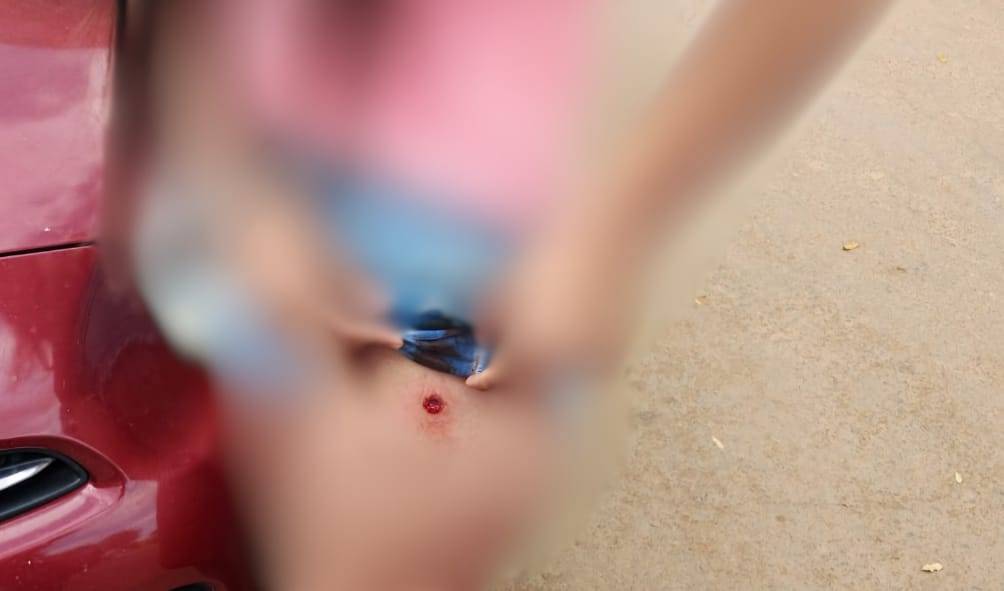 Jovem também ficou ferida durante ataque a tiros que deixou um morto e outro em estado grave, em Vilhena