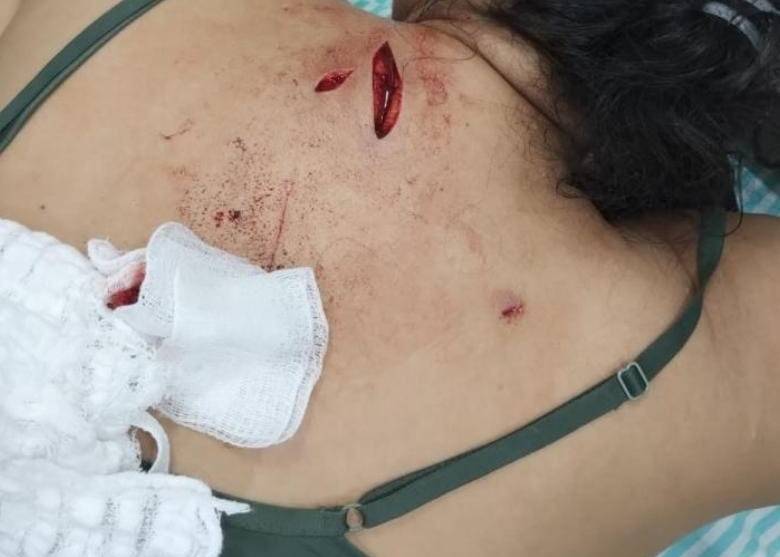 Cusparada no rosto e facadas: discussão descamba para briga e termina com mulher ferida pela própria filha adolescente, em Vilhena