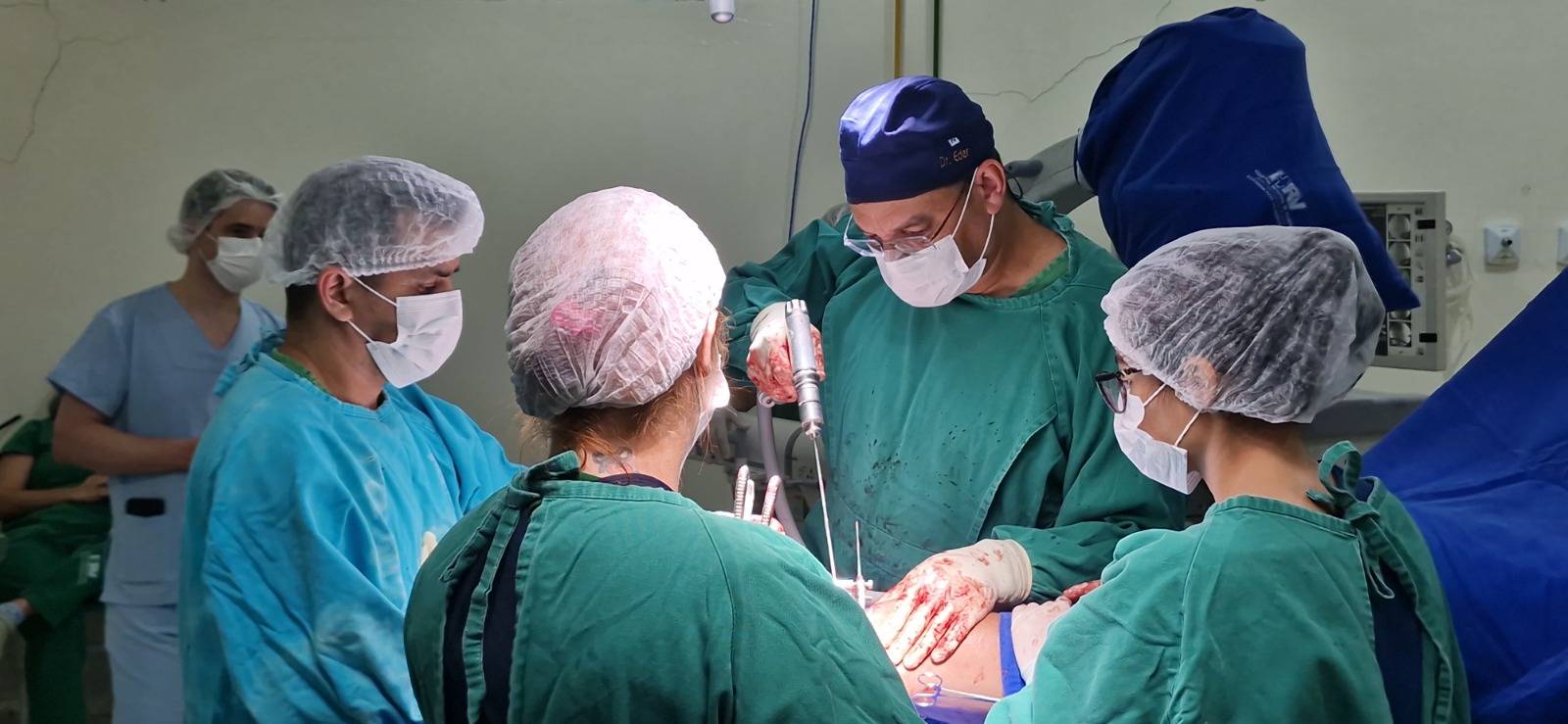 ASSISTA VÍDEO: médico realiza, no Hospital Regional de Vilhena, cirurgia inédita de tíbia com técnica russa