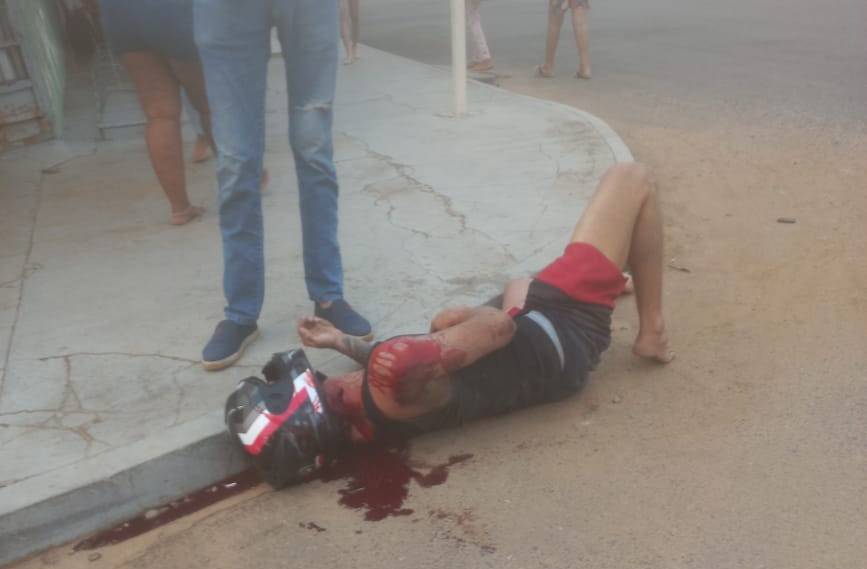 Apesar da imagem impactante, jovem de 18 anos fotografado após acidente envolvendo carro e moto em Vilhena está consciente