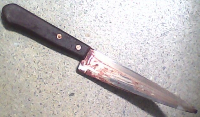 Sem motivo, adolescente é atacado por desconhecidos e sofre corte no pescoço