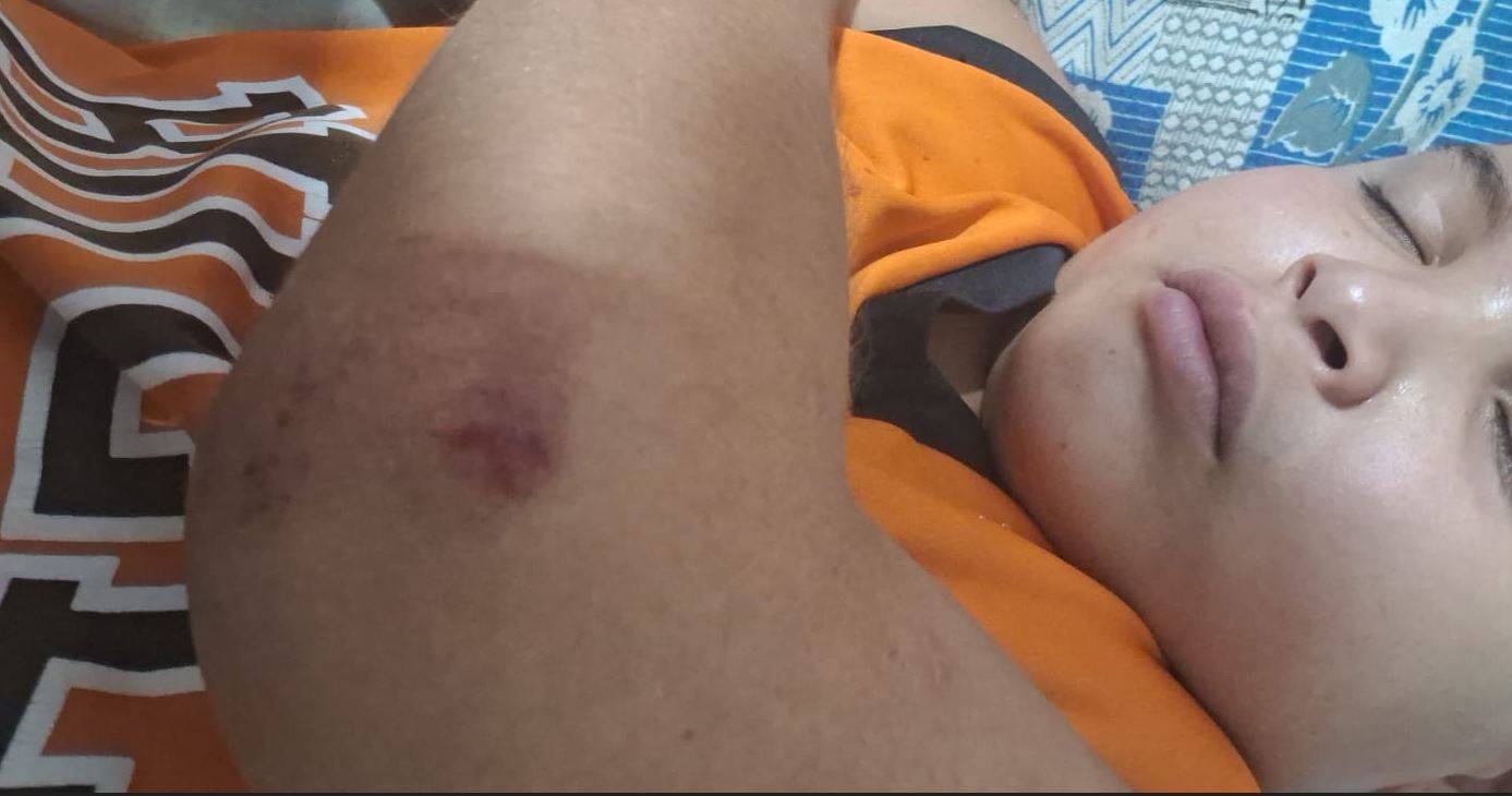 Mãe de garoto de 11 anos atropelado em frente à AABB de Vilhena por motorista “com bons advogados” aciona a polícia