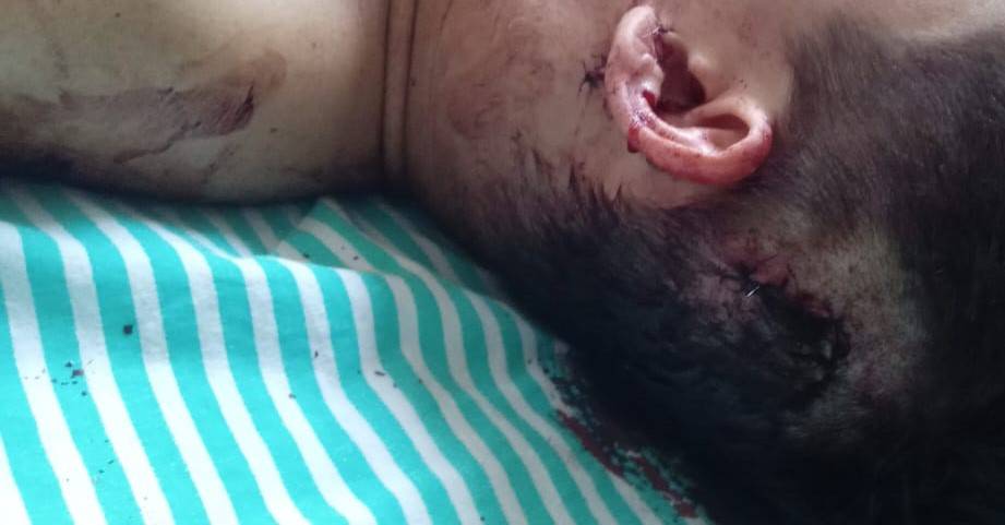 Esfaqueado em casa noturna de Vilhena, rapaz de 24 anos é socorrido pelo Corpo de Bombeiros e corre risco de ficar paraplégico