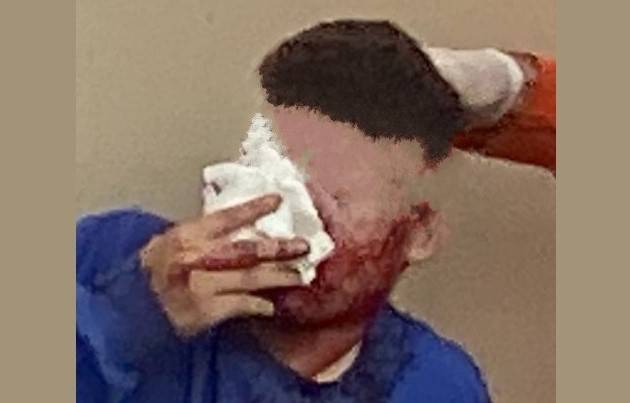 Homem baleado no rosto após matar um em Vilhena deixa a UTI; tiro foi dado pelo próprio comparsa, revela fonte do FOLHA DO SUL